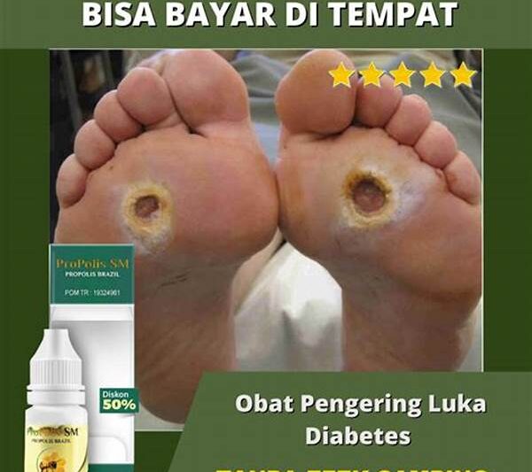 Herbal Luka Lecet Tanpa Efek Samping