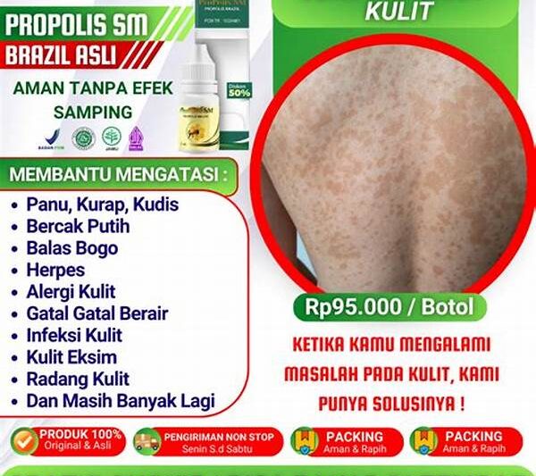 Mengatasi Infeksi Kulit Secara Herbal