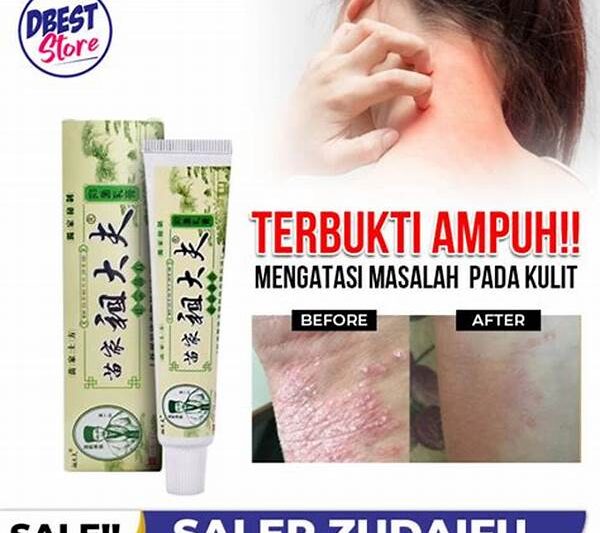 Ramuan Herbal Penyembuh Infeksi Kulit